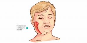 Honnan származik a mumpsz, mik a tünetei és hogyan kell kezelni