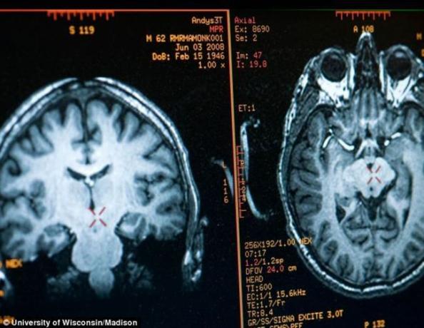 agy Matthieu Ricard képet kapott MRI