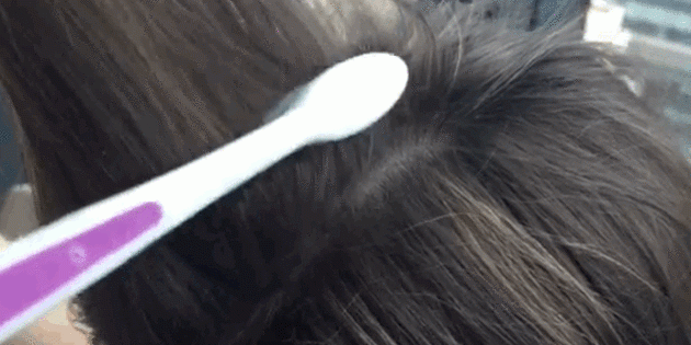 Hogyan tud a haj mennyisége