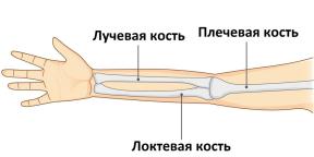 Hogyan lehet felismerni a törött karot, és mi a teendő?