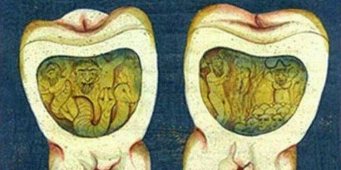Középkori orvostudomány: Egy oldal az oszmán fogászati ​​értekezésből, 17. század.