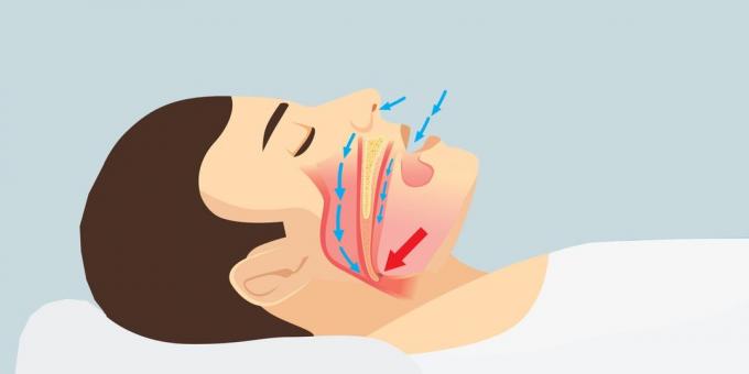 Hogyan válhat egészségesebb 2019: Miért horkolunk és hogyan kell megállítani