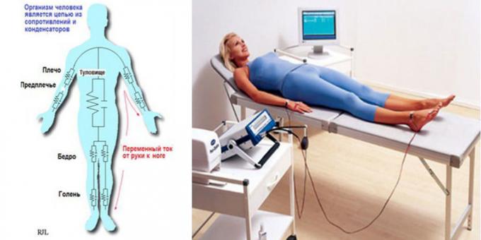 Body bioimpedanciás elemzés eszköz „MEDASS”
